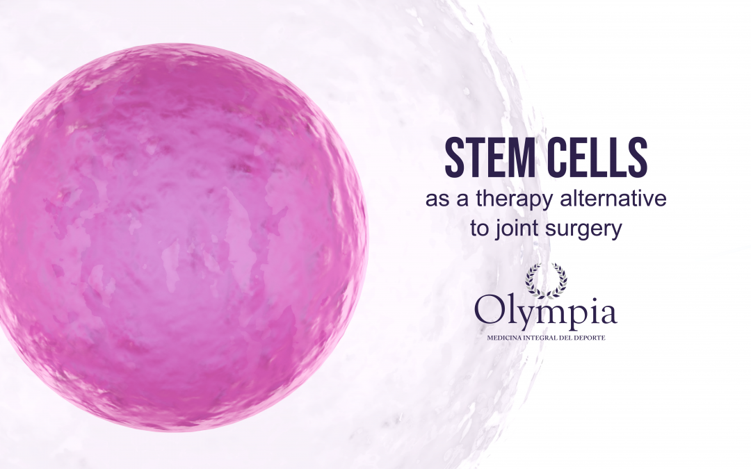 Stem cells as a therapy alternative to joint surgery