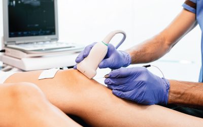 Proliferation therapy or Prolotherapy